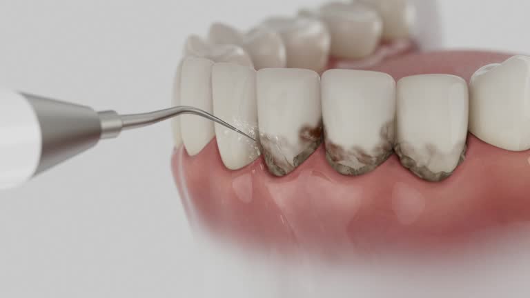 Reliable Tooth Extraction contractor in Terrebonne Parish County, LA by Dentist Open Now